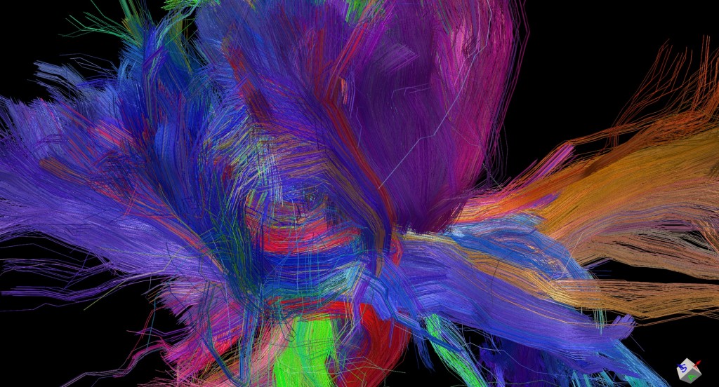 BeautifulBrain01