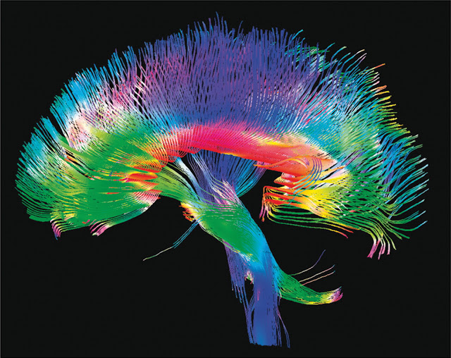 BeautifulBrain03